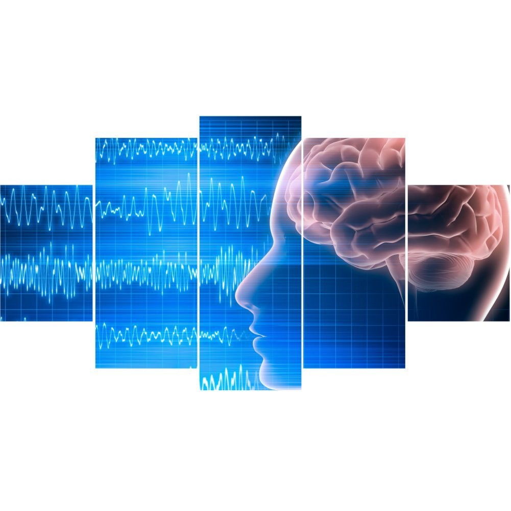 Quadro Decorativo Mosaico Medicina Encefalograma - Quadros Decorativos para Sala | Display de Festa Infantil