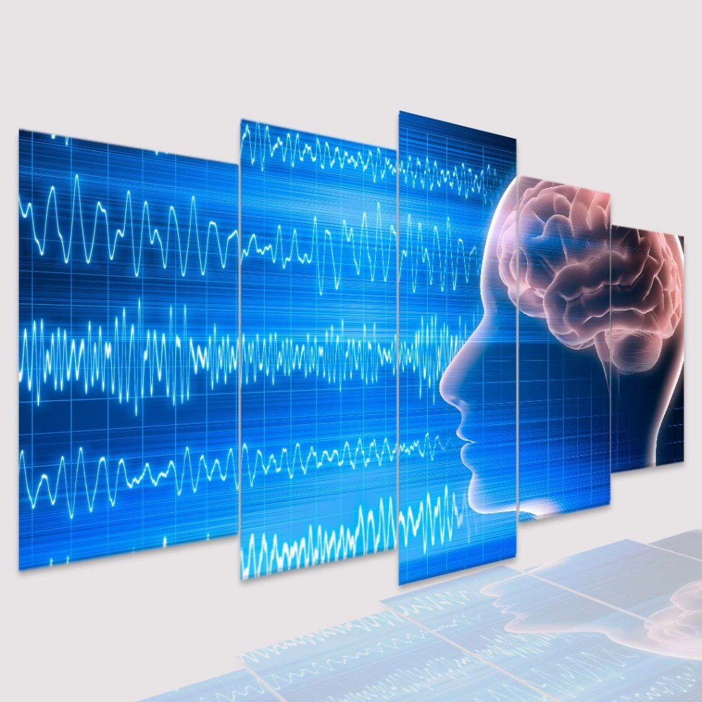 Quadro Decorativo Mosaico Medicina Encefalograma - Quadros Decorativos para Sala | Display de Festa Infantil